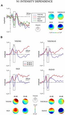 Event-Related Potentials to Changes in Sound Intensity Demonstrate Alterations in Brain Function Related to Depression and Aging